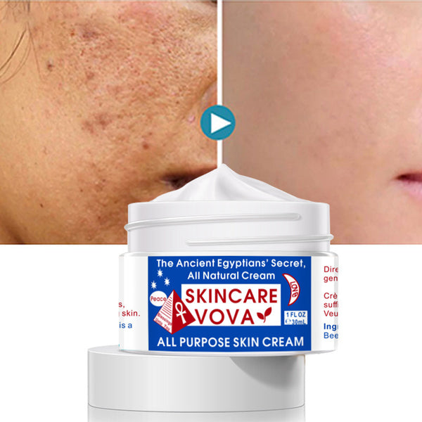 Skincare Vova cream jar with before and after skin comparison