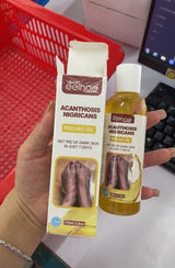 Product packaging for Acanthosis Nigricans treatment with a hand holding it.